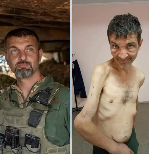 Ukrainian Soldier Released From Russian Captivity Looks Emaciated