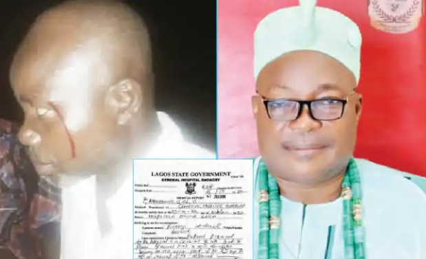 Lagos monarch allegedly punches, injures chief, alleges disrespect