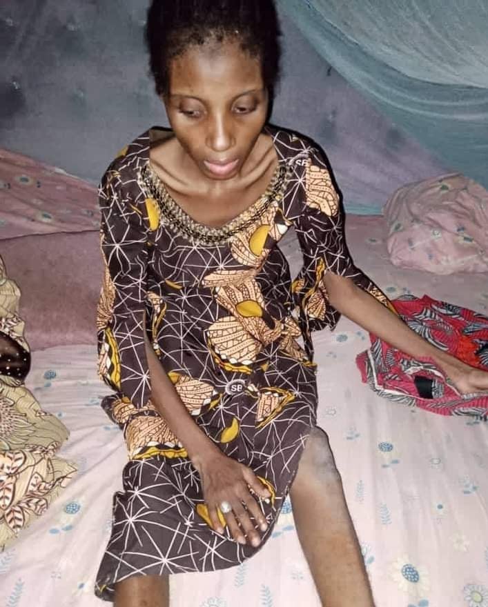 Yobe woman starved by husband for one year dies in hospital