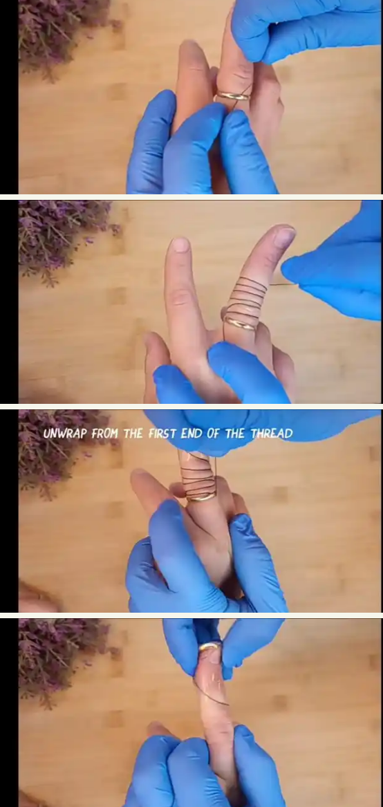 Easy Steps For Removing A Ring Stuck On Your Finger