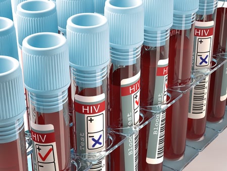 HIV vaccine fails during trial