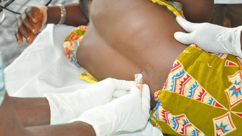 Meningitis claims 118 lives in 21 states