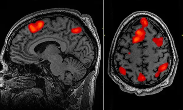 Scientists now use brain scans, AI to ‘decode’ thoughts