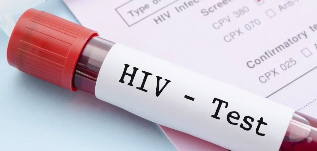 Concerns as HIV prevalence soars in Akwa Ibom