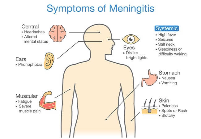 Gombe discharges 284 fully recovered meningitis patients