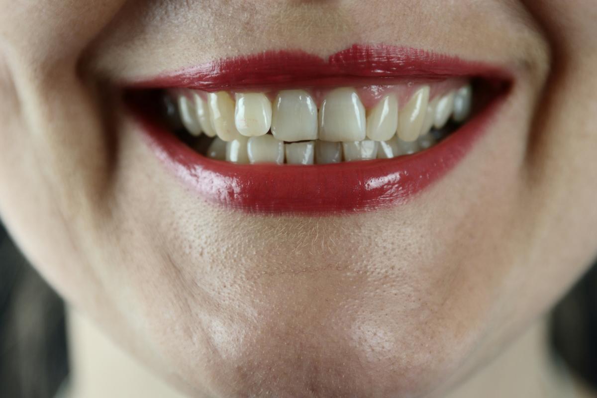 The World’s First Tooth-Regrowing Drug Has Been Approved For Human Trials