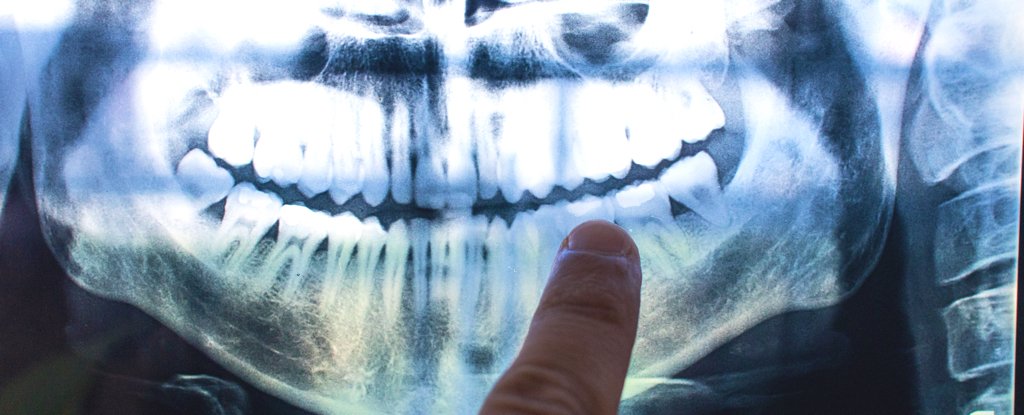 Most of The UK Predicted to Have Dental Disease by 2050, Study Finds