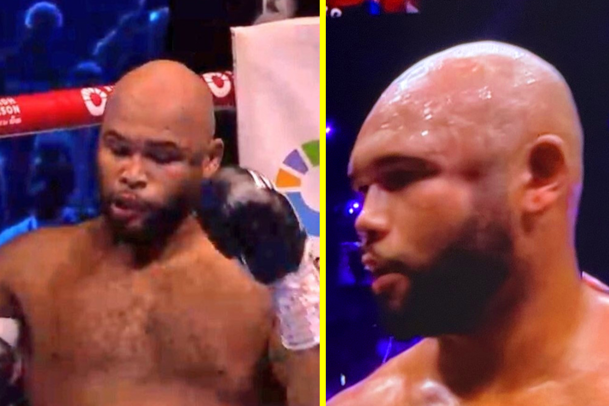 ‘Never seen anything like it’ – Frazer Clarke left with huge dent in side of his head after Fabio Wardley’s stunning first round KO