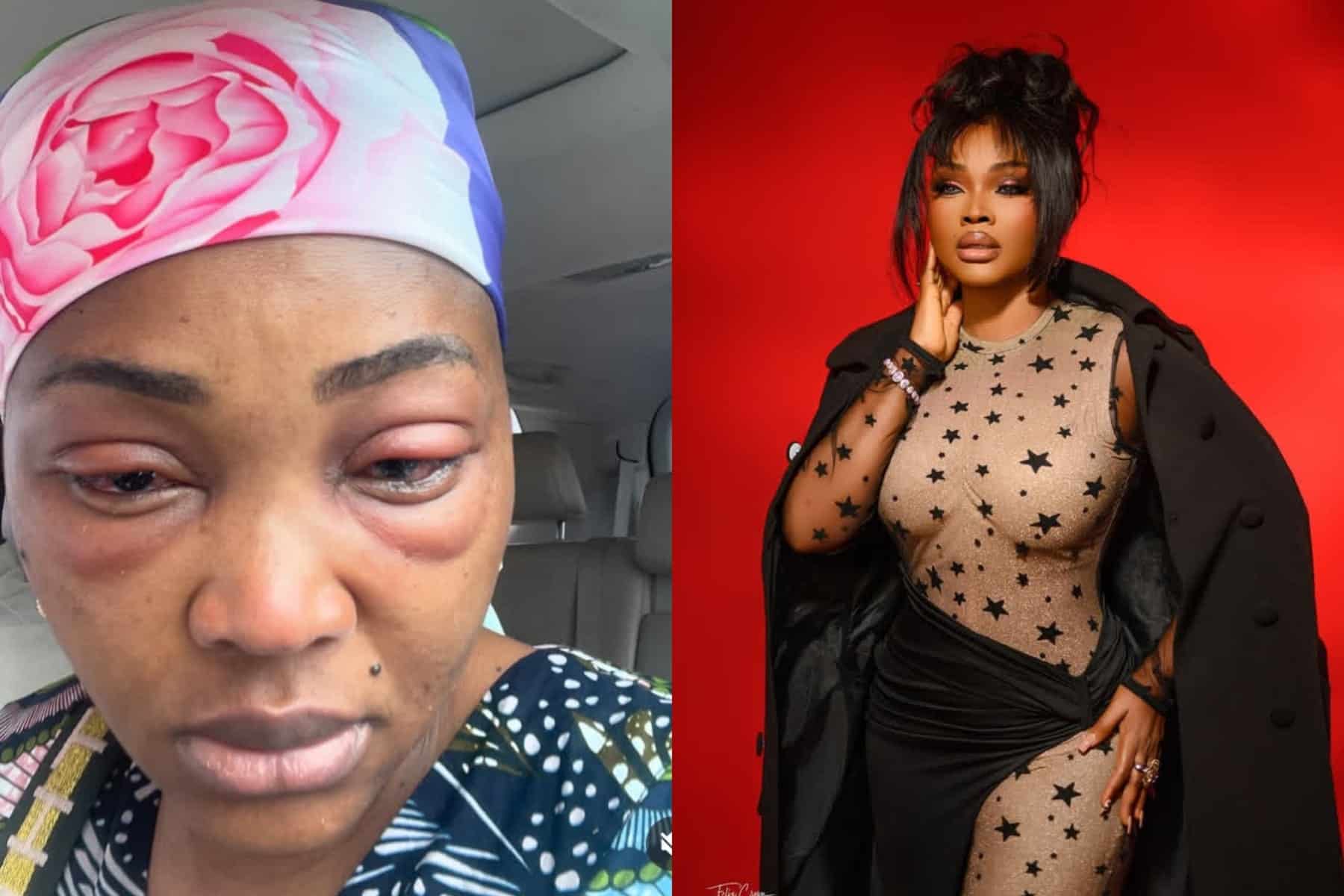 “I was hospitalized and it was a whole lot” – Mercy Aigbe reminisces on the excruciating pain she suffered while filming her new movie, Thinline