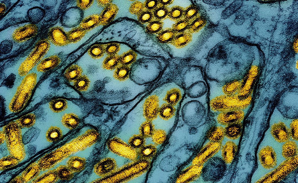 Louisiana Person Is the First U.S. Bird Flu Death