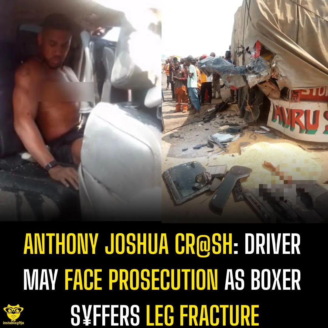 Anthony Joshua Cr@sh: Driver May Face Prosecution as Boxer S¥ffers Leg Fracture