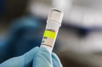 UK identifies new suspected hantavirus case on remote island | Health News