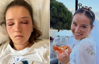 Bride gets severe allergic reaction to eyelash extensions before wedding